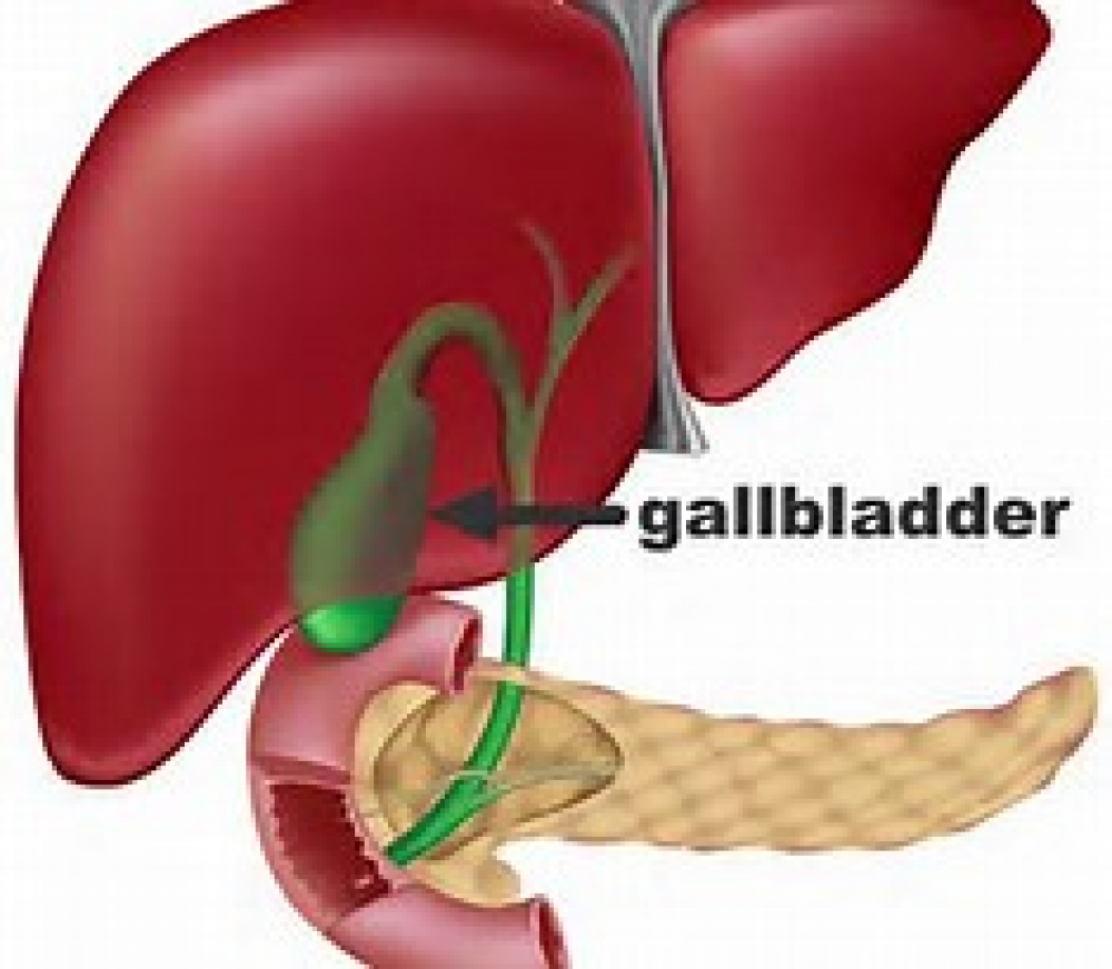 gallbladder issues symptoms gallbladder issues symptoms